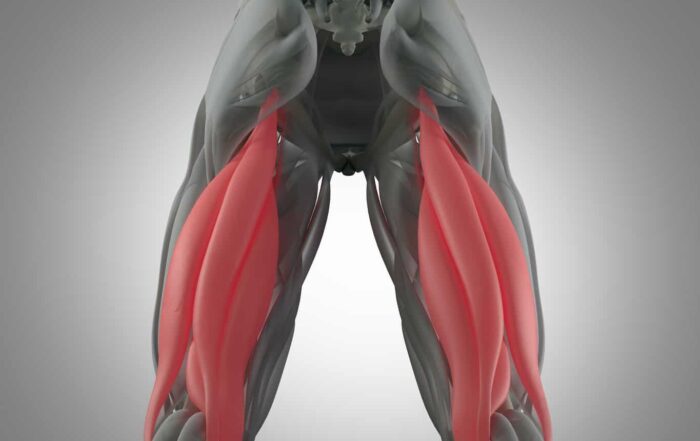 There are three hamstring muscles. The symptoms of a hamstring strain include pain and swelling