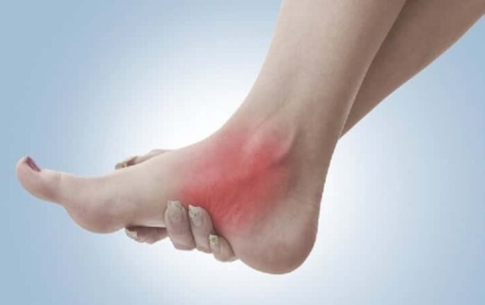 ankle physical therapy can help you walk, run, or even prevent surgery