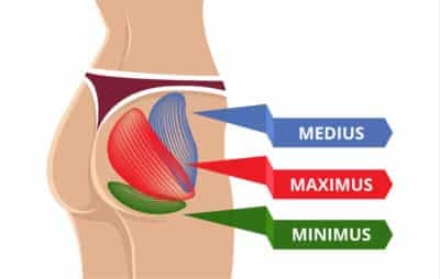 What Is Gluteal Tendinopathy and Why Is It Common in Women?