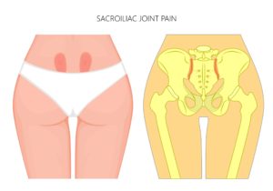 Relieve Back Sciatica Hip And Tailbone Pain With This Dark - Temu