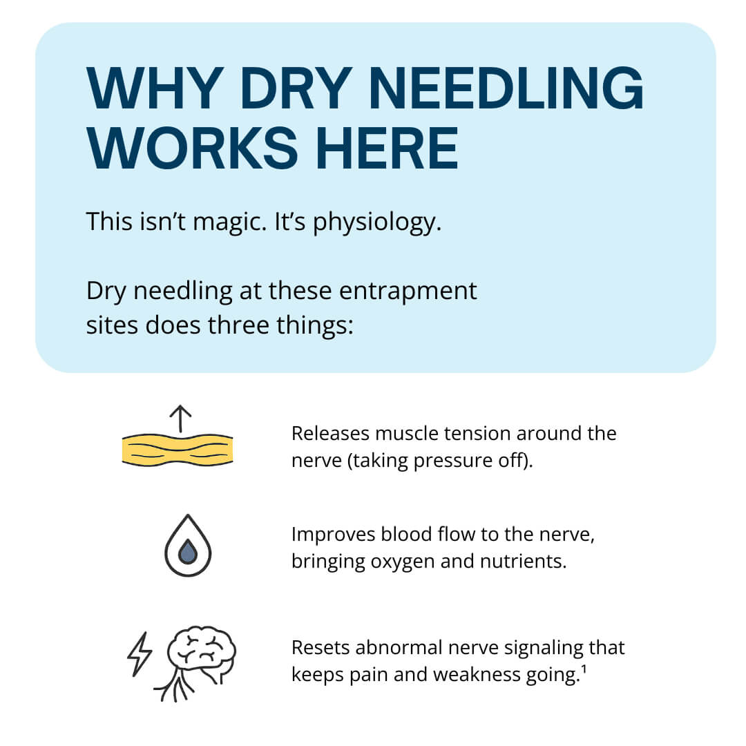 Why Dry Needling Works Here